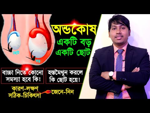 অন্ডকোষ একটা বড় একটা ছোট | কারণ - লক্ষণ ও চিকিৎসা