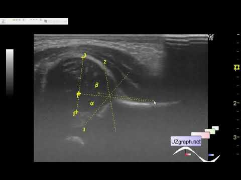 Www Dermpathdiagnosticspatientsbilling