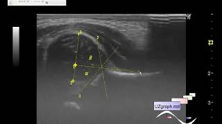 Angle online-measurement example