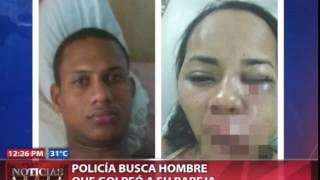 Policía busca hombre que golpeó a su pareja