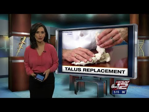 VIDEO: Talus Replacement Saves Feet