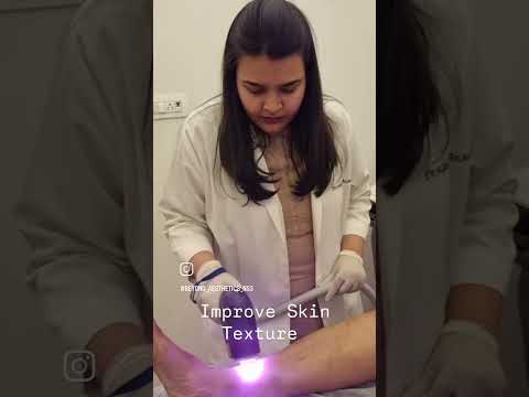 Laser Hair Reduction with Miles man compact machine