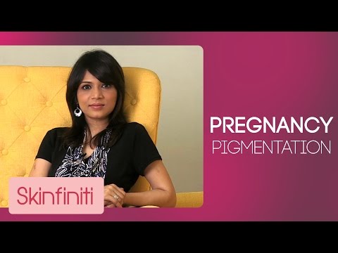 La chiarificazione di pigmentary individua la persona Argilla per la persona pigmentary posti