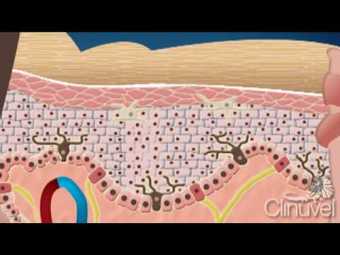 What is skin? The layers of human skin