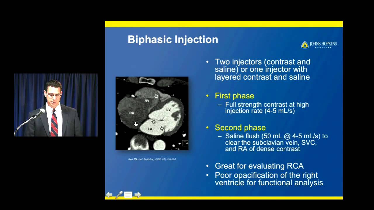 Cardiac CT: How Do you do it