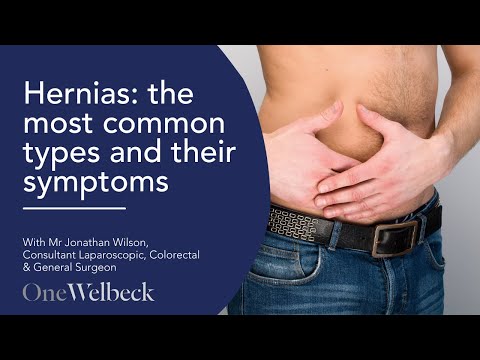 What are the most common types of hernias and what are the symptoms? | Mr Jonathan Wilson