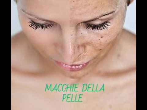 Stelle con lentiggini di fotografia La crema che candeggia la linea pura