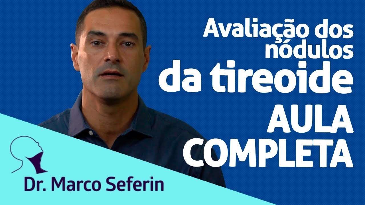NÓDULOS NA TIREOIDE: sintomas, exames, ultrassom e PAAF do nódulo na tireoide