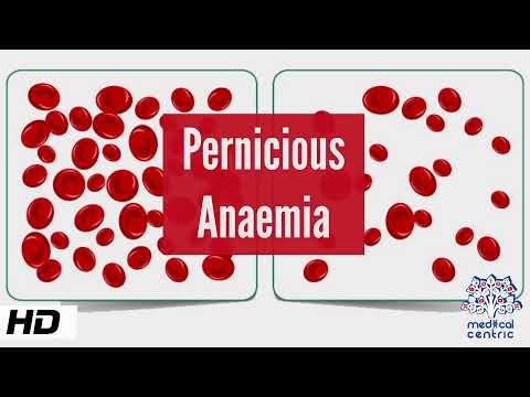 Pernicious Anemia, Causes, Signs and Symptoms, Diagnosis and Treatment.