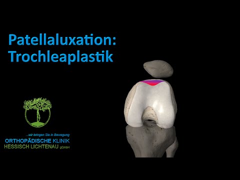 Shungit Balsam Creme in den Gelenken Wenn das Schultergelenk geklopft