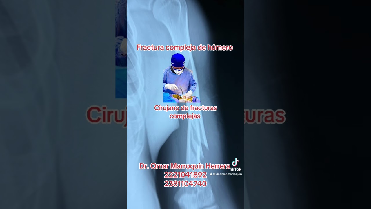 Omar Marroquín Herrera-98