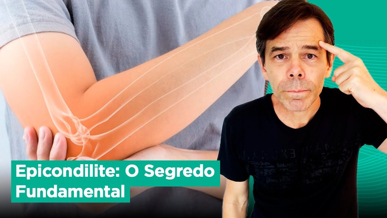EPICONDILITE: SEGREDO FUNDAMENTAL