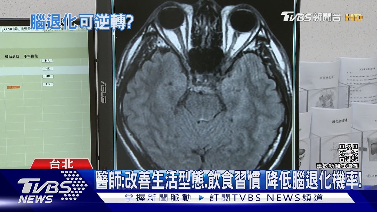 經常做「這件事」!加速腦退化 醫師:認知功能受影響
