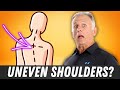 Shoulders Uneven? One Shoulder Higher? Why & How to Fix Easily.