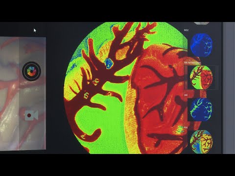 Hightech aus Leipzig - Computergestützte Medizin im OP