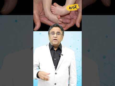 Club foot | Identification, Precautions and Treatment | Dr AV Gurava Reddy | #clubfoot #shorts