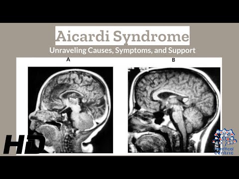 Effects of Cannabis on your body