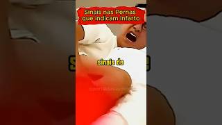 SINAIS DE INFARTO NAS PERNAS #saude #saudavel #infarto #coração #sintomas