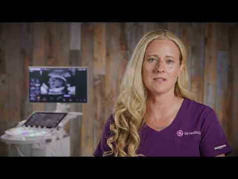 Streamline OB ultrasound with SonoBiometry 