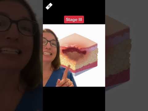 Pressure Injury Staging: Wound Care