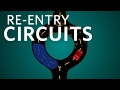 Cardiology Re Entry Circuits Cardiology Ubcmedicine
