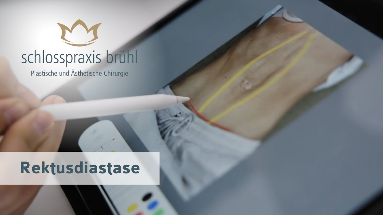 Maximilian A. Rossbach-12