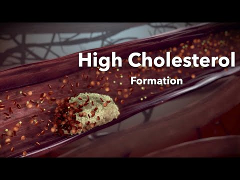 Is High Cholesterol Dangerous?