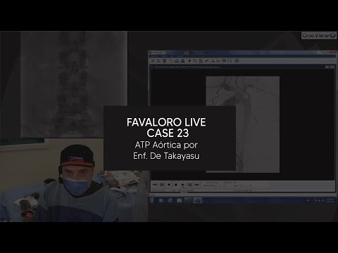 Favaloro Live Case N° 23 - ATP Aórtica por Enf.  De Takayasu