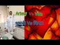 Difference Between Artery Versus Vein In The Human Body L Types Of Artery Vein And Pulmonary Arter