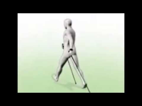 Dopo la gamba protesi danca è stata più lunga Faringite, mal di collo da dietro