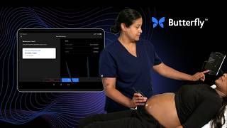 ButterflyのAI搭載妊娠週数計測ツールの使い方｜ステップバイステップ・チュートリアル