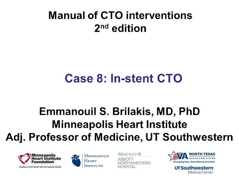 Case 8: Manual of CTO Interventions - Investment for ISR CTO