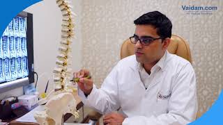 Spine Fixation Explained by Dr. Manish Raj of Yatharth Hospital, Noida