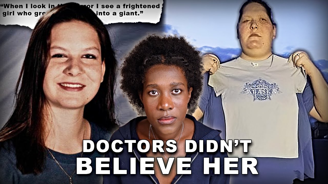 She Had One of The Worst Cases of This Rare Disease | The Case of Tanya Angus