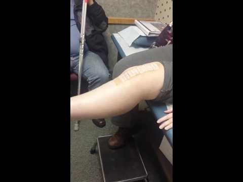 2 weeks after knee replacement