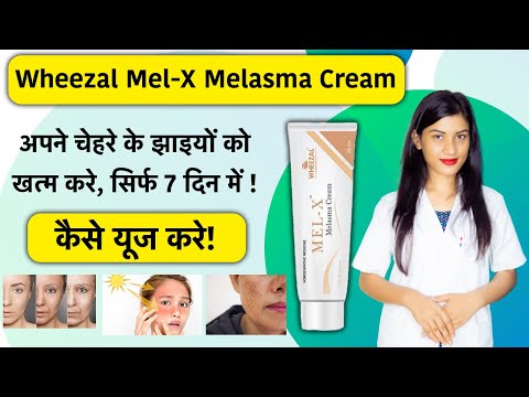 Wheezal Mel-X Cream Uses in Hindi | Wheezal Mel-X Cream Review | Mel X Cream | Mel X Melasma Cream