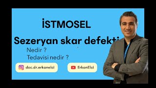 İstmosel Nedir? Sezaryen Skar Yeri Defekti