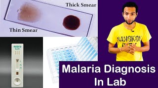 How To Diagnosis Malaria  At  Laboratory