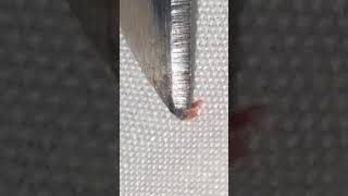 Micro Lip Morg ..... Morgellons : the Modern Black Plague