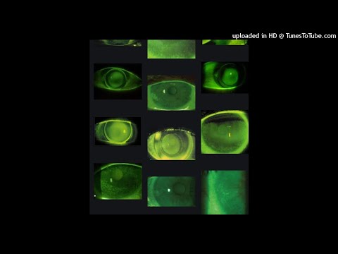 [Free] Khali x Azur x Bitsu Type beat - " Solo " - (prod.Malfoy)