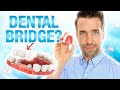 You Need To Know This About A Dental Bridge