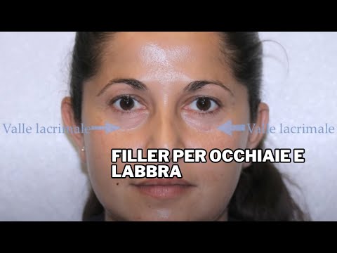 Iniezioni di Botox in una faccia I takecarestudio affrontano il pacco