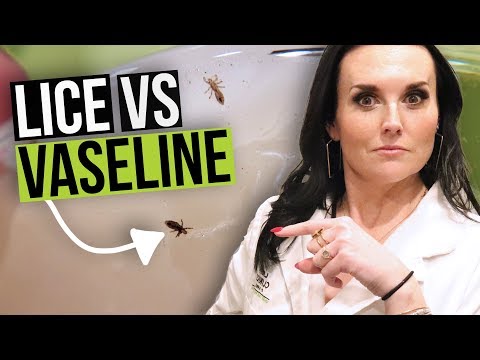 Get Rid of Lice with Vaseline? - Head Lice Home Remedy Test