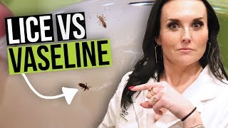 Get Rid of Lice with Vaseline? - Head Lice Home Remedy Test