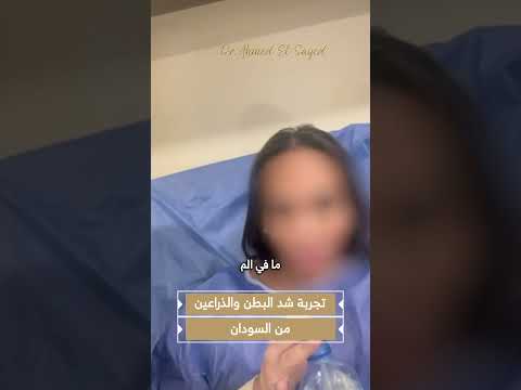 نتائج شد البطن والزراعين مع دكتور احمد السيد