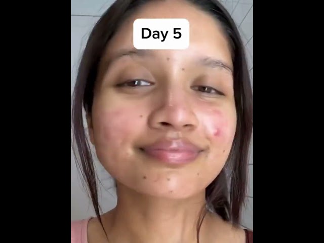 تونر الأرز من Anua Rice 70 Toner