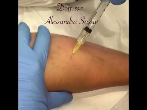 Il mal di schiena e sul lato sinistro delle cause addome Che punge fare con cervicale osteocondrosi toracica