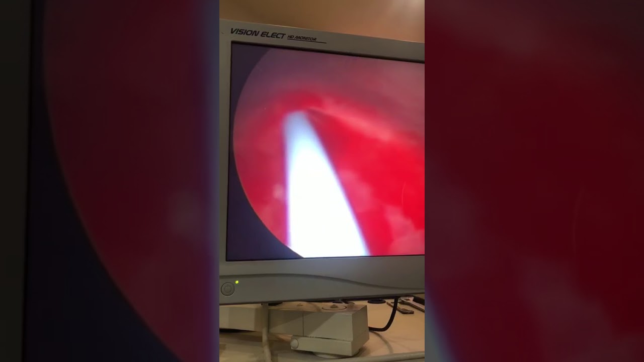 Brian Axel Rojas Bahena-7