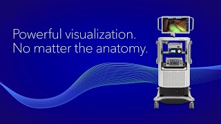 Powerful visualization no matter the anatomy.
