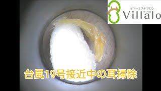 耳掃除動画vol.73「台風19号接近中の耳掃除」